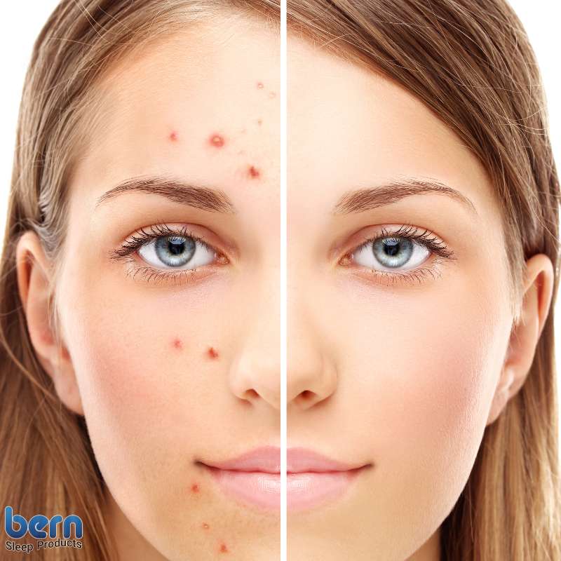 بی‌خوابی و کاهش زیبایی و شادابی موها